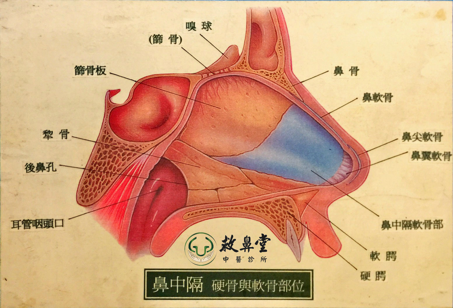 鼻中膈彎曲